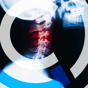 neck injuries