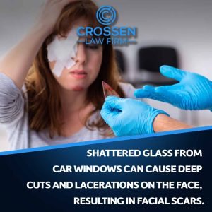 facial scars from a car accident