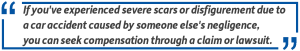 facial scar attorney