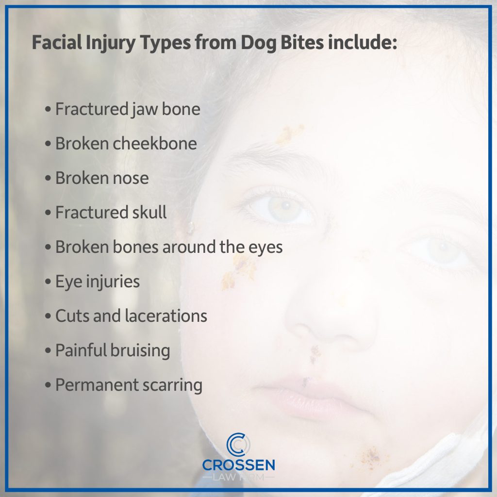 List graphic: Facial injury types from dog bites include fractured jaw bone, broken cheekbone, broken nose, fractured skull, broken bones around the eyes, eye injuries, cuts and lacerations, painful bruising, and permanent scarring.