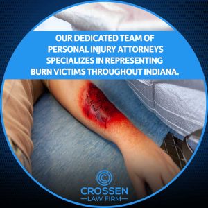 crossen burn injuries throughout indiana