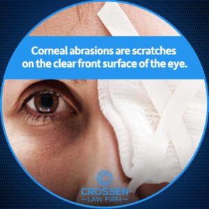 corneal abrasions