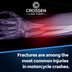 fractures